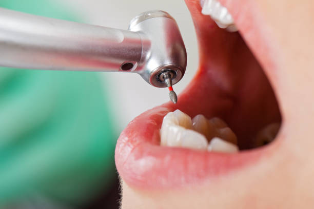 Best Emergency Treatment for Dental Infections or Abscesses in Hudson, MI